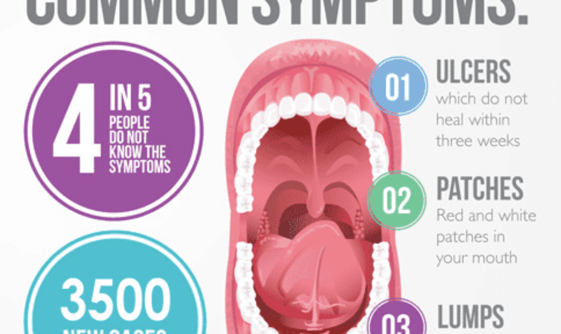 Blog - Absolute Dental