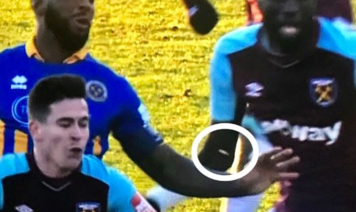 Blog - Absolute Dental