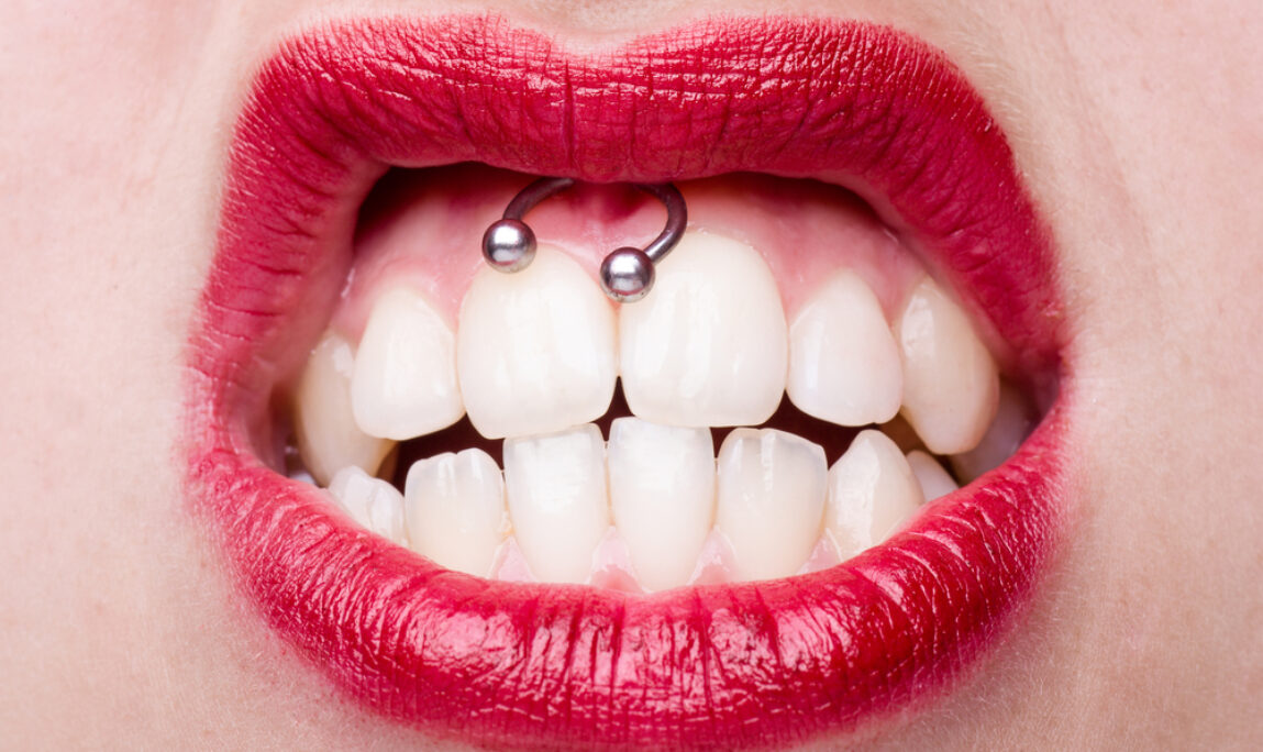 Blog - Absolute Dental